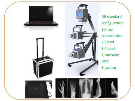 WMV670A Veterinary Portable X Ray System