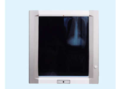 56"*17" xray viewer Medical film viewer/x ray film viewer/x-ray film viewing box