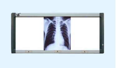 56"*17" xray viewer Medical film viewer/x ray film viewer/x-ray film viewing box