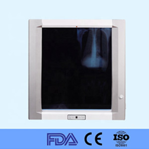 Hospital LED X Ray medical film viewer