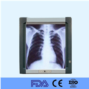 Hospital LED X Ray medical film viewer