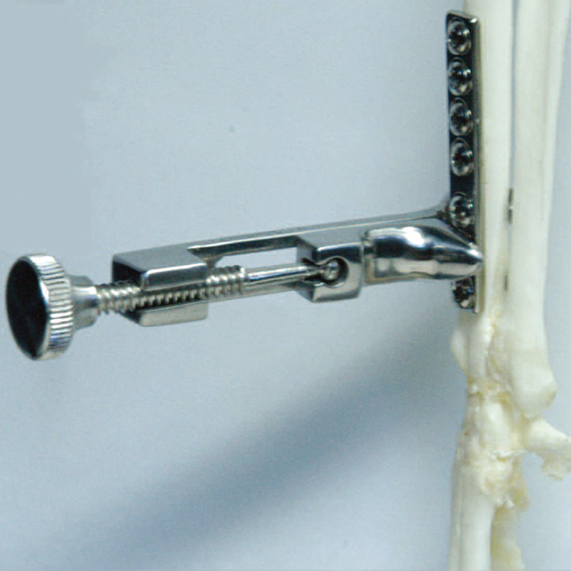 Lowman Bone Clamp