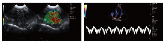 Wondcon WMV-T8-VET High-end Trolley Veterinary Color Doppler