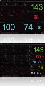 WMV-650M Multi-parameter Monitor