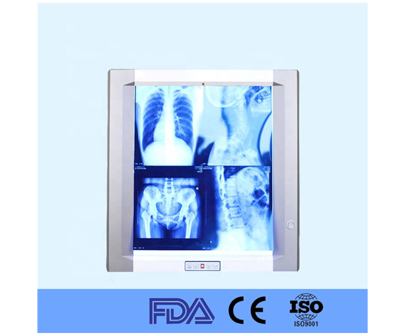 Hospital LED X Ray medical film viewer