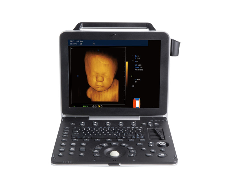 Wondcon WMV-P60 High-end Portable Color Doppler